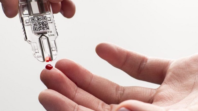 Point Of Care Diagnostics Market Latest Trends and Insight Analysis by 2025