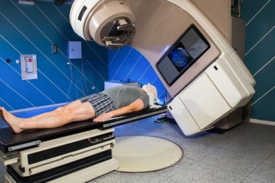 What Are the Side Effects of Radiotherapy?
