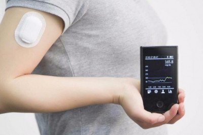 Continual Glucose Monitors (CGM) Devices Keep Track Of And Monitor One's Blood Glucose Throughout The Day
