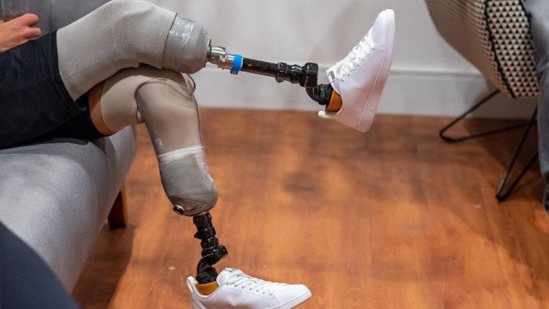 Prosthetic Legs Market Scope, In-Depth Analysis, Top Key Players, Reviews And Forecast To-2028