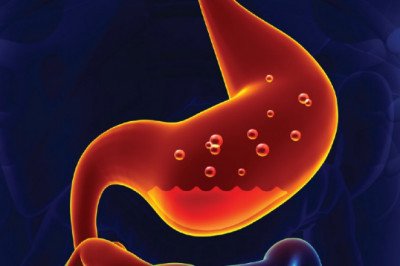 The Gastritis Treatment You Choose Will Depend On Your Condition's Severity, The Underlying Cause, And The Underlying Cause
