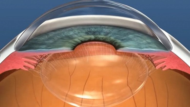 A study of the global Refractory Glaucoma Treatment Market : trends, market size, growth, opportunity, as well as forecasts for 2022-2028