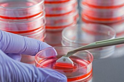 Forecasting 2022-2028: Global Tissue Transplantation Products and Services Market trends, share, size, growth, opportunities, and forecasts