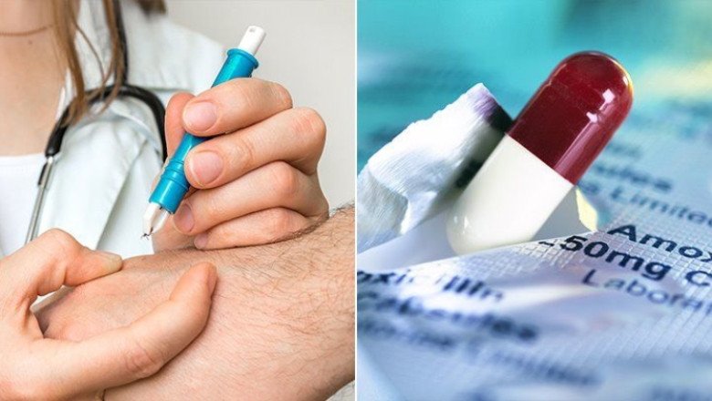 Using Lyme Disease Treatment To Cure Early Stages