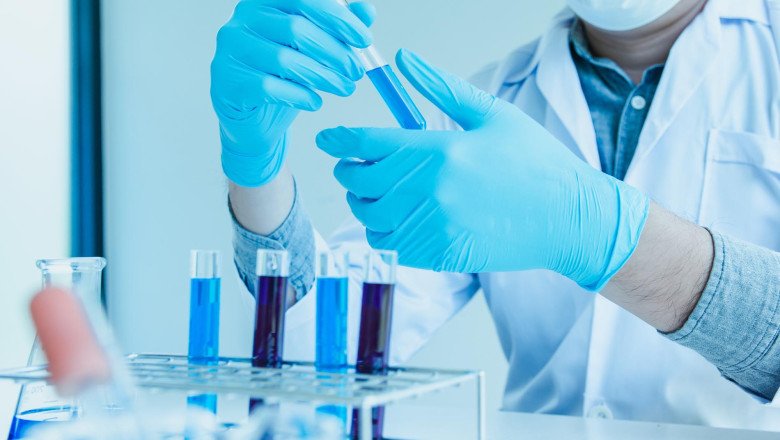 Global Mexico In-Vitro Diagnostics Market : Share, Size, Growth, Opportunity, and Forecast 2022-2028