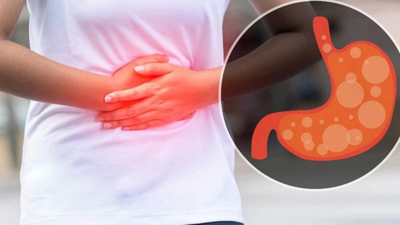 H2 Blockers, Antacids, Or Proton Pump Inhibitors Are Available For The Gastritis Treatment