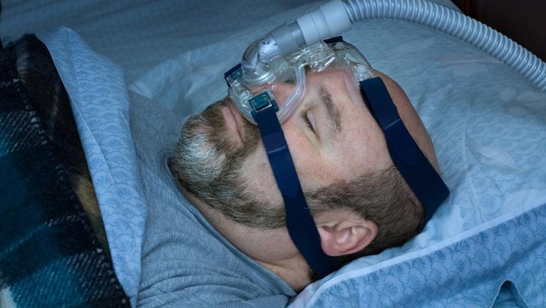 Air Is Pumped Into The Lungs By A Breathing Machine, Which Supports Or Replaces The Activity Of Breathing
