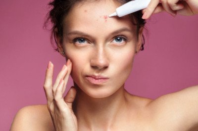 A Common Acne Medication Is Benzoyl Peroxide And Adapalene Used Together