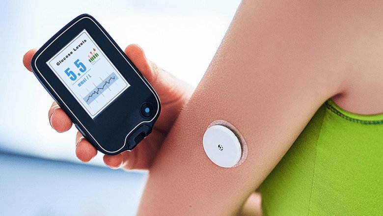 Continuous Glucose Monitoring (CGM) Devices Help People With Type 1 And Type 2 Diabetes Reduce The Number Of Fingerstick Tests They Need To Do