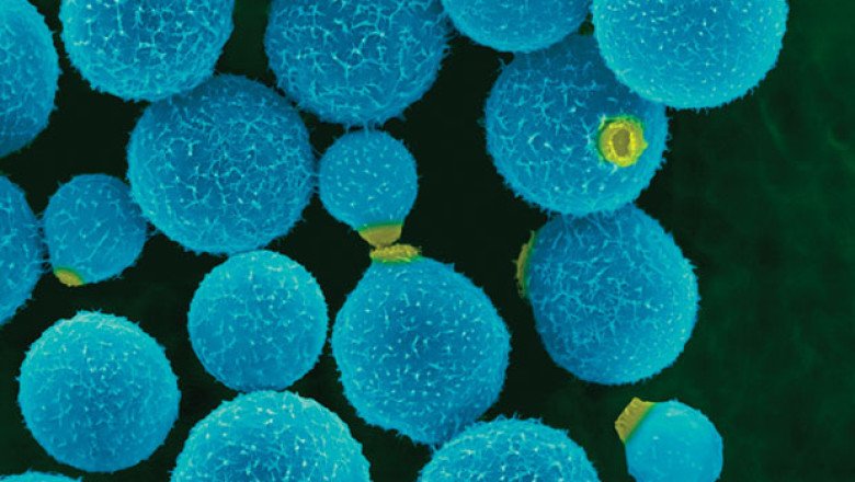 Global Cryptococcosis Treatment Market : Share, Size, Growth, Opportunity, and Forecast 2022-2030