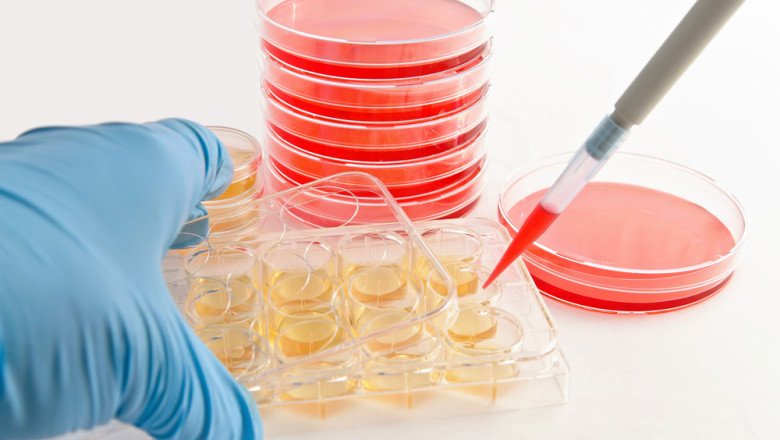 Global Cell Culture Media for Vaccine Market : Share, Size, Growth, Opportunity, and Forecast 2022-2030