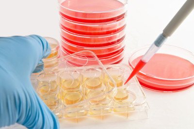 Global Cell Culture Media for Vaccine Market : Share, Size, Growth, Opportunity, and Forecast 2022-2030