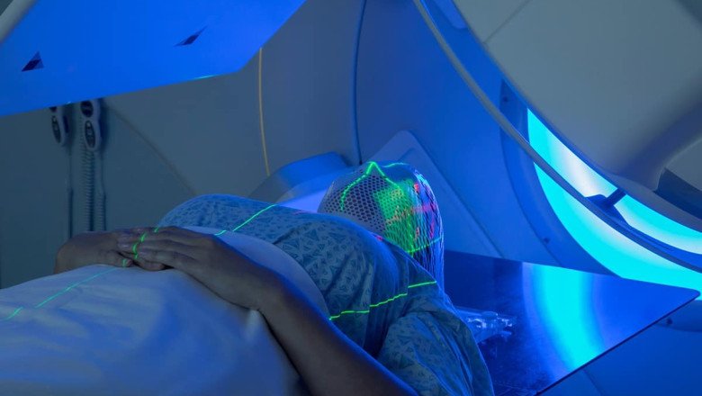 The Treatment Of Cancer By Radiotherapy Involves Using High-Energy Radiation