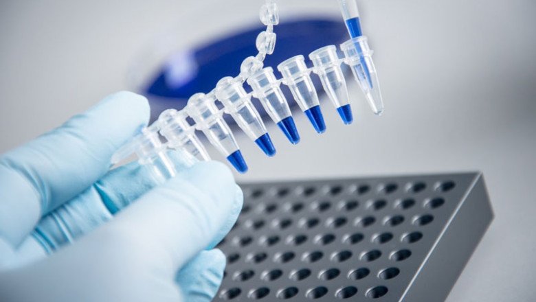 Molecular Biology Relies Heavily On Polymerase Chain Reaction (PCR)