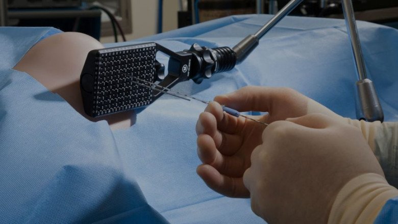 Radiation Is Used In Brachytherapy To Treat Cancer By Placing A Radiation Source Near Affected Areas