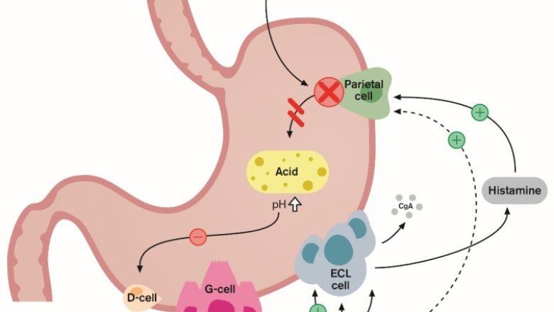 Inhibitors Of Proton Pump Inhibitors Cause Stomach Acid Production To Be Greatly Reduced And Prolonged