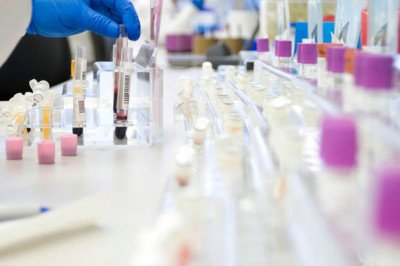 Biobanking Market: Size, Share &amp; Trends To 2033