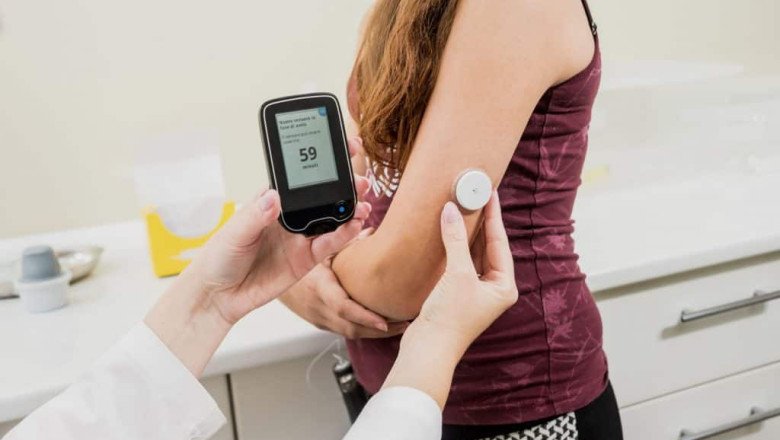 Continuous Glucose Monitoring (CGM) Devices Market Analysis Report, Share, Trends and Overview 2022-2030