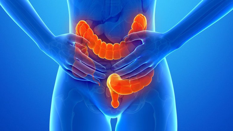 Irritable Bowel Syndrome Treatment Market Exploration, Trends, Analysis and Forecast by 2022- 2030