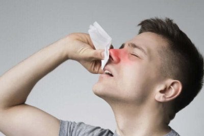 Winter Is A Time When Upper Respiratory Infections Are More Common, So Epistaxis Is More Common