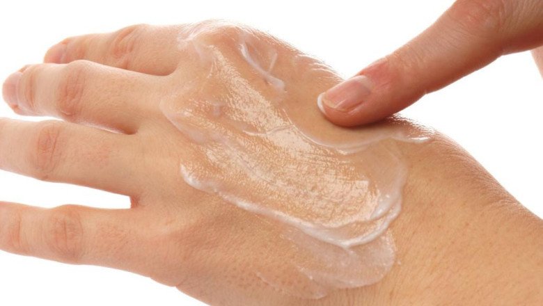 Medically, Burn Ointments And Scald Creams Are Helpful For Treating Burns And Scalds