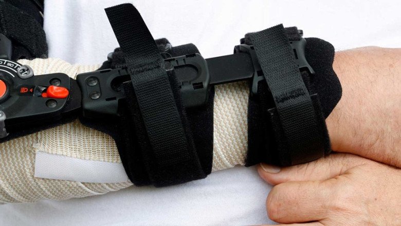 Challenges and Opportunities in the Cast Removal Device Market