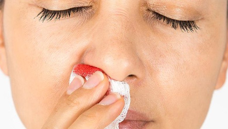 Geographical Analysis of Epistaxis Market, Forecast 2019-2027