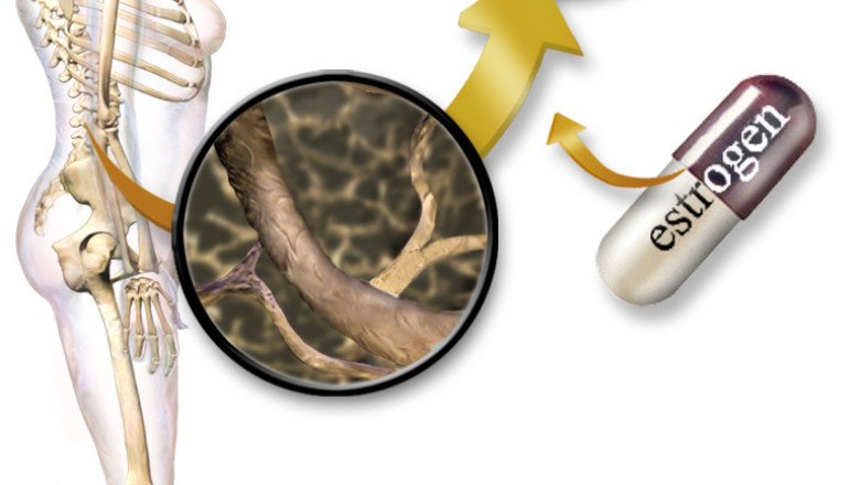 In Situations Where The Body Cannot Produce Enough Hormones, Hormone Replacement Therapy Replaces Them With Synthetic Ones