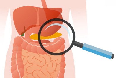Prescription Exocrine Pancreatic Insufficiency (EPI) Therapeutics: Dosage and Administration Guidelines