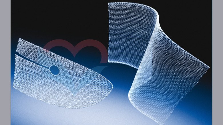 Applications of Mesh Nozzle Plates Market in Wastewater Treatment and Environmental Protection