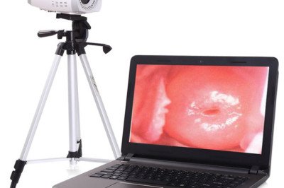 Medical Devices Such As Colposcope Are Used To Examine The Cervix, Vagina, And Vulva In Detail