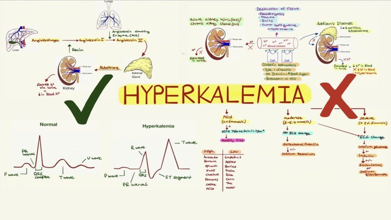 Hyperkalemia Treatment Market Insights, Analysis