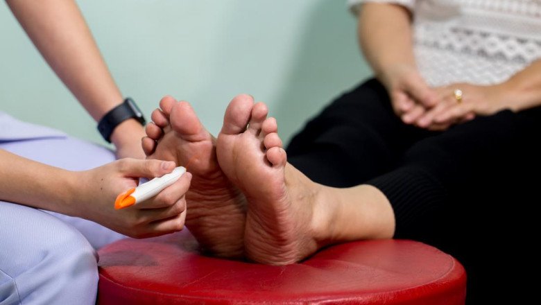 Global Diabetic Neuropathy Market Is Estimated To Witness High Growth Owing To Increasing Prevalence Of Diabetes And Rising Demand For Effective Treatment Options