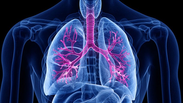 Pulmonary Edema Therapeutics Latest Advancements in the Development of Pulmonary Therapeutics